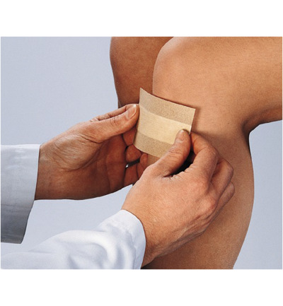 Curaplast Wondpleister sensitive 5m x 6 cm (1 rol)