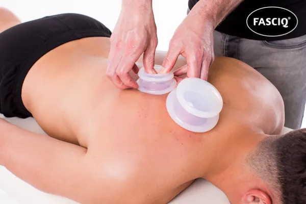 Fasciq Full Body Cupping Set (4 stuks)